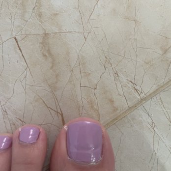 Lulu Nails & Spa - You can see the growers since he filed my toes down so much and severely damaged them. This is 6 weeks post that pedicure. - Day Spas Near Me - Hollywood, Florida Lulu Nails & Spa - You can see the growers since he filed my toes down so much and severely damaged them. This is 6 weeks post that pedicure. - Day Spas Near Me - Hollywood, Florida