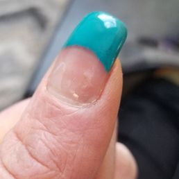 Star nails,top coating chipped off,uneven nails, bubblingunder nails.So thin that my nails broke within days. Star nails,top coating chipped off,uneven nails, bubblingunder nails.So thin that my nails broke within days.