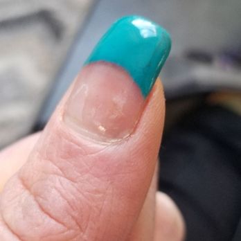 Star Nails - Star nails,top coating chipped off,uneven nails, bubblingunder nails.So thin that my nails broke within days. - Nail Salons Near Me - Billings, Montana Star Nails - Star nails,top coating chipped off,uneven nails, bubblingunder nails.So thin that my nails broke within days. - Nail Salons Near Me - Billings, Montana