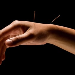 EverWell Acupuncture Center
