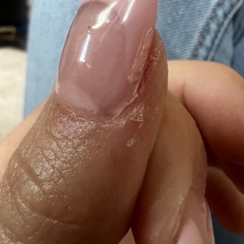 VIP Nails & Lash - A more clear picture or f how glued the skin was - Nail Salons Near Me - Thornton, Colorado