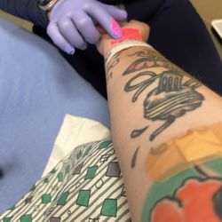 Dublin Methodist Hospital - They even took out a machine to locate veins