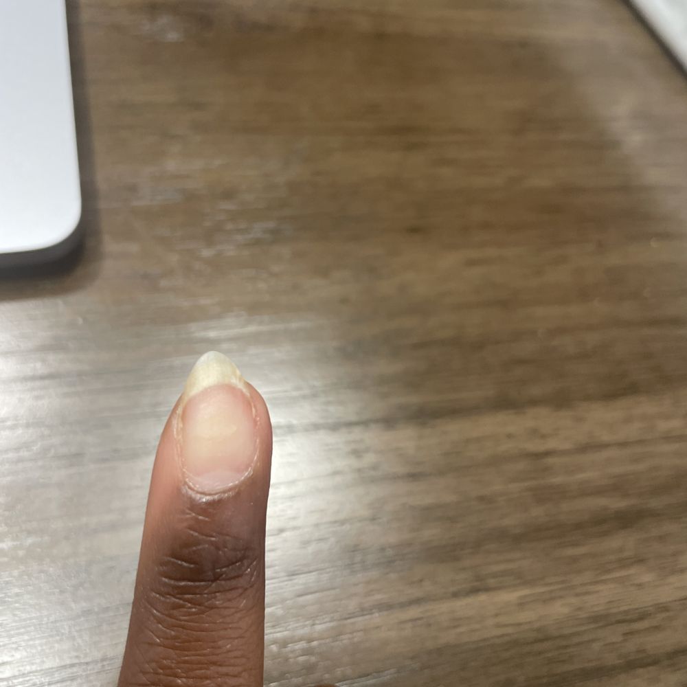 Terrible job at filing almond shape nails. Unprofessional business lacking proper skill set amongst employees. Terrible job at filing almond shape nails. Unprofessional business lacking proper skill set amongst employees.