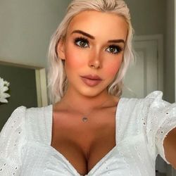 Delaware Valley Plastic Surgery - Lip and cheek fillers by nurse Marla! (: