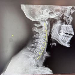 Van Dyck Family Chiropractic - Before Treatment