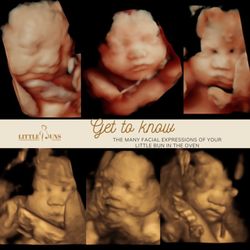 Little Buns Ultrasound & Baby Boutique - Little buns Scottsdale, where you can see your little one in a clear 3D, 4D, and 5D prenatal ultrasound!