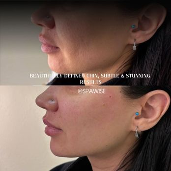 Spawise Medspa - Medical Spas Near Me - Dallas, Texas Spawise Medspa - Medical Spas Near Me - Dallas, Texas