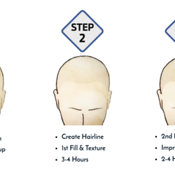 Tailored Micro Ink - 3 Step Process for how SMP Treatment works. No need to take time off work, as it is non-invasive, safe, and painless procedure.