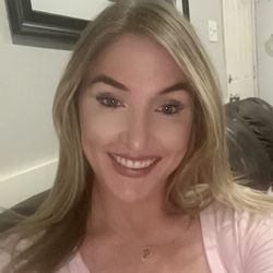 Michel Siegel: Facial Center for Plastic Surgery - 2 weeks after the Botox had settled by Dr. Michael Siegel. I could not be happier.