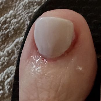 LaRose Nail Boutique - Burned and cut my toe. Very painful. Put Neosporin on it. 3 hrs later...dried blood all around the nail. - Nail Salons Near Me - Paradise Valley, Arizona LaRose Nail Boutique - Burned and cut my toe. Very painful. Put Neosporin on it. 3 hrs later...dried blood all around the nail. - Nail Salons Near Me - Paradise Valley, Arizona