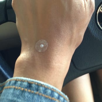 Holistic Health Center - Pain killer... Patch with needle for one week. Ouch!!! - Acupuncture Near Me - Menlo Park, California Holistic Health Center - Pain killer... Patch with needle for one week. Ouch!!! - Acupuncture Near Me - Menlo Park, California