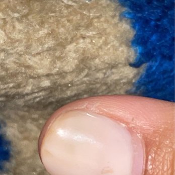 Bellaviva Nail Bar - yellowing on my nail - Nail Salons Near Me - Aurora, Illinois