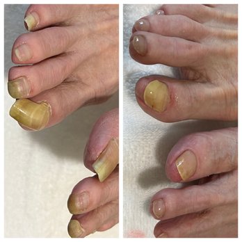Nails by Luisa Advanced Nail Solution - Thick long nails - Nail Technicians Near Me - Frisco, Texas Nails by Luisa Advanced Nail Solution - Thick long nails - Nail Technicians Near Me - Frisco, Texas