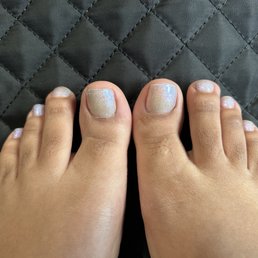 You can see the little scabs on my cuticle area You can see the little scabs on my cuticle area
