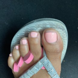 The big toe was filled down beyond my nail bed. The big toe was filled down beyond my nail bed.