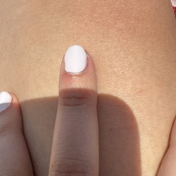 Blue Ocean Nails Spa - Cuticle and skin abrasion from drill - Nail Salons Near Me - San Diego, California