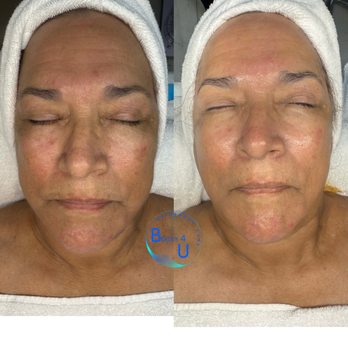Beauty 4 U - Ultimate Glow Up Facial - Skin Care Near Me - Covina, California Beauty 4 U - Ultimate Glow Up Facial - Skin Care Near Me - Covina, California