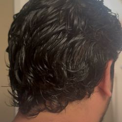 Epiphany Dermatology - After