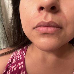 Same evening I got wax done. Same evening I got wax done.