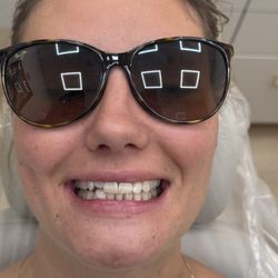 Naples Dental and Wellness Center - Before