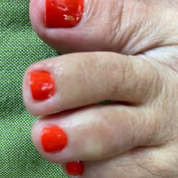 Polish over cuticles and on skin around toe.