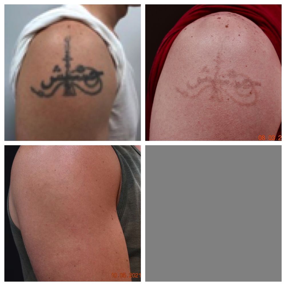 ZAPATAT HERNDON Updated September 2024 28 Photos 452 Elden St