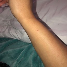 First poke because the nurse like this vein "better" First poke because the nurse like this vein "better"