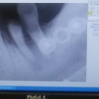 Aslemand Fariba, DDS - Before - General Dentistry Near Me - Rockville, Maryland