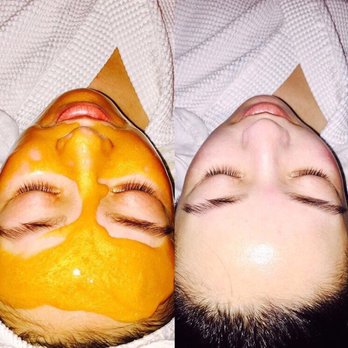 Top Skincare SF - Organic diamond & gold facial - Skin Care Near Me - San Francisco, California Top Skincare SF - Organic diamond & gold facial - Skin Care Near Me - San Francisco, California
