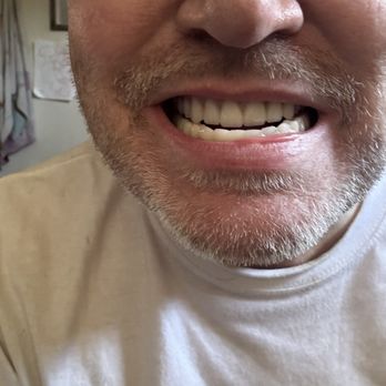 Eureka Dental Group - New teeth - General Dentistry Near Me - West Sacramento, California Eureka Dental Group - New teeth - General Dentistry Near Me - West Sacramento, California