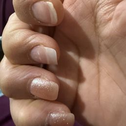 What I got and 5 day old with two lifted nails. What I got and 5 day old with two lifted nails.