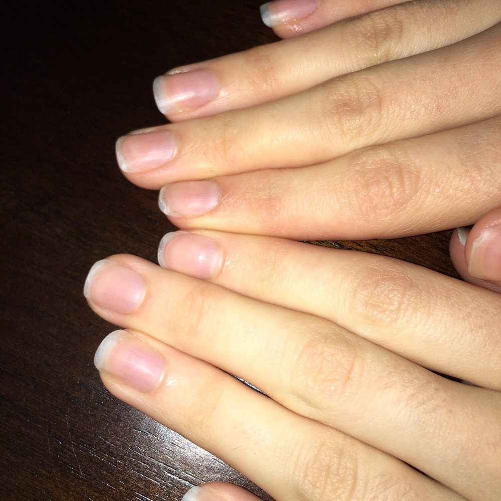 Artistic Nails and Spa - After three weeks - Nail Salons Near Me - Vienna, Virginia