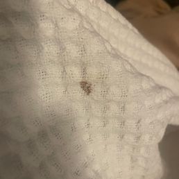 Stain on sheets