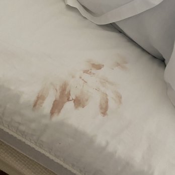 Stamford Marriott - Blood hand print - Hotels Near Me - Stamford, Connecticut Stamford Marriott - Blood hand print - Hotels Near Me - Stamford, Connecticut