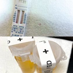 Delicate Hands Mobile Lab - Rapid or DOT/NON DOT drug screens. Contact us for more details @ 786.6139822