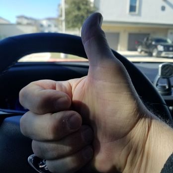 Ideal Dental Cedar Park - Total thumbs up for the front office and Doctor. - General Dentistry Near Me - Cedar Park, Texas Ideal Dental Cedar Park - Total thumbs up for the front office and Doctor. - General Dentistry Near Me - Cedar Park, Texas