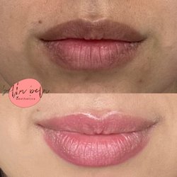 Bella Bela Aesthetics