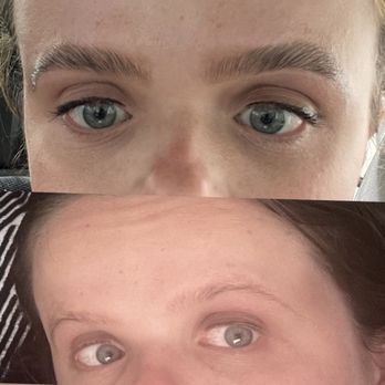Poe Brow + Skin Studio - Before and after - Skin Care Near Me - Berkeley, California