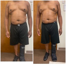 Beauty Dimensions - 1st Cavitation Session