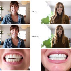 Rise and Shine with your New smile.