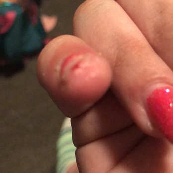 JC Nail & Spa - My pinky nail after I cut the fake nail down - Nail Salons Near Me - Gloucester City, New Jersey JC Nail & Spa - My pinky nail after I cut the fake nail down - Nail Salons Near Me - Gloucester City, New Jersey