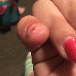My pinky nail after I cut the fake nail down