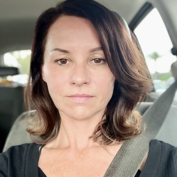 ST Med Spa - June 2023. Before Dalton did my lips. - Medical Spas Near Me - Encino, California ST Med Spa - June 2023. Before Dalton did my lips. - Medical Spas Near Me - Encino, California