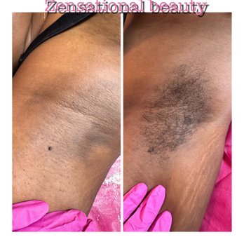 Zensational Beauty - Under arm wax - Waxing Near Me Zensational Beauty - Under arm wax - Waxing Near Me