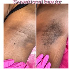 Zensational Beauty - Under arm wax