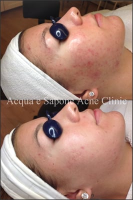 AES Acne Clinic by null