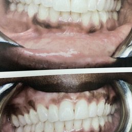 Teeth