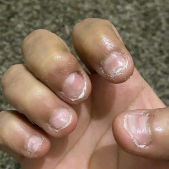 Pro Nails & Spa - Fucked up my nails Smfh - Nail Salons Near Me - Laurel, Maryland