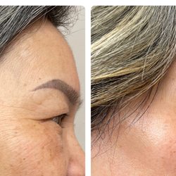 LT Beauty - Crows feet and eye wrinkle treatment!