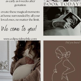 Eclipse 4D Mobile Ultrasounds - We come to you! - Ultrasound Imaging Centers Near Me Eclipse 4D Mobile Ultrasounds - We come to you! - Ultrasound Imaging Centers Near Me